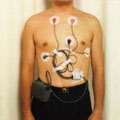 Cardio Electrofisiología